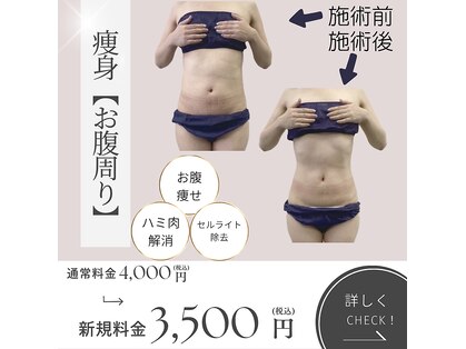 ラピス リラクゼーションエステ(Lapis. relaxation esthe)の写真