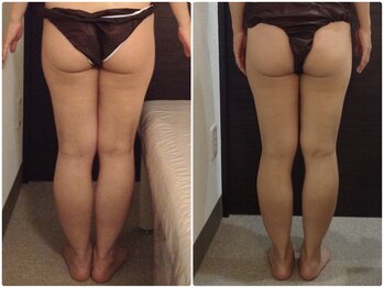 美容整体ウェリナ 名駅院/小顔矯正/骨盤矯正/美脚サロン