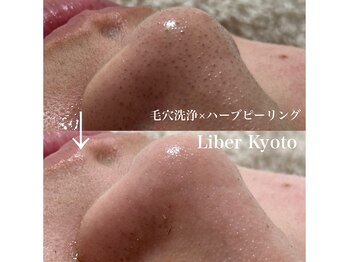 リベルキョウト 京都駅前店(Liber Kyoto)/毛穴レス艶肌コース