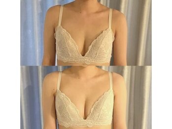 ジョリー(Jolie)/