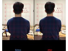 ストレチックス 近江八幡店/慢性腰痛を改善したい男性