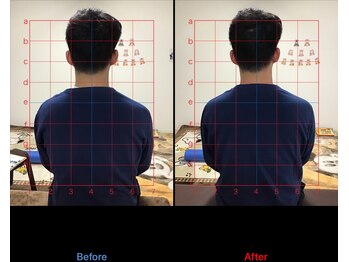 ストレチックス 近江八幡店/慢性腰痛を改善したい男性