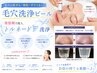【毛穴レス艶肌】毛穴洗浄フェイシャル5回券　￥44,000→￥22,000
