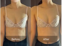 ハートランド(HEARTLAND)/プチ・クレオパトラ　1回