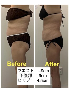 アールボディバランス/【3ヵ月モニター様】50代