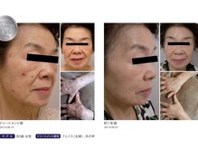 オレンジバナナ 県央店/【ホワイトスノーピール】