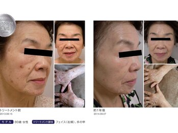 オレンジバナナ 県央店/【ホワイトスノーピール】