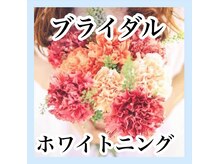 ホワイトニングサロン ホワイト(WHITE)/セルフホワイトニング/大阪/福島