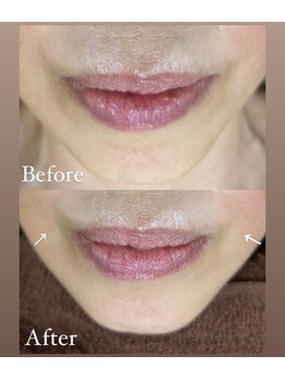 コーラル(CORAL)/60代*小顔リンパフェイシャル*