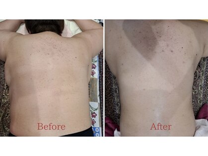 韓国エステサロン 憩の写真