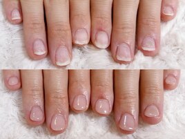 深爪長さだしフィルイン自爪育成