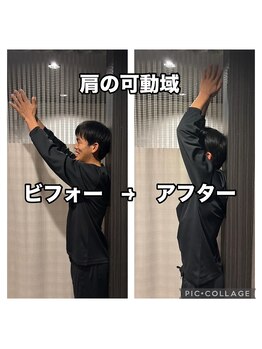 ボディーリセット(BODY RESET)/◆姿勢改善のビフォーアフター