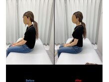 整体リアン 天神院(Lien)/ビフォーアフター：座位姿勢