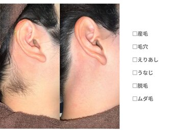 ピュアノア 三木店/えりあし|うなじ脱毛　三木/小野