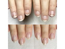 イズム(Izm)の雰囲気（深爪・割れ爪・年齢によるお悩みも丁寧に対応します）