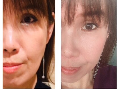 サロン ド ルポゼ(Salon de Reposer)の写真