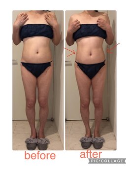 モイス(moisu)/バザルトストーンボディ