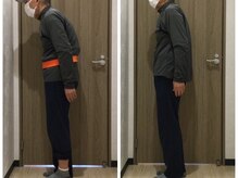 くすの樹接骨院 整体院 吉野ヶ里院/整体/骨盤矯正ビフォーアフター