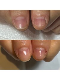 看護師のお客様の自爪育成ネイル