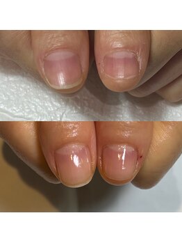 キュア(Cure.)/看護師のお客様の自爪育成ネイル