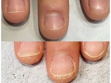 グレースレディ 神戸北店/