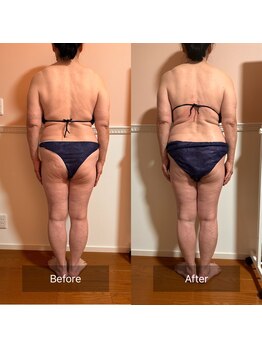 トータル フィルシャイン(Total Fillshine)/本気痩せ全身コース6回