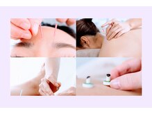 美麗鍼灸院の雰囲気（身体の巡りを調整して健康・キレイのお手伝い・自分治癒力♪）
