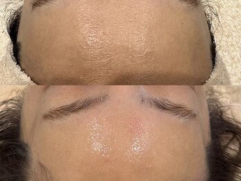 キュアフロウ 橿原店/4回来店☆肌のキメ作り