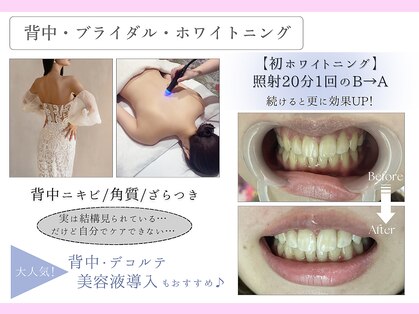 フレイヤ(FREYA)の写真