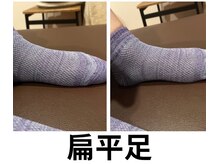 カワル整体 長嶺院/扁平足