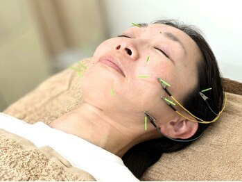 ホシ治療院の写真/【肌質改善/小顔】電気美容鍼×ドライヘッドスパで、貴女の理想をカタチにします！[リフトアップ/小顔◎]