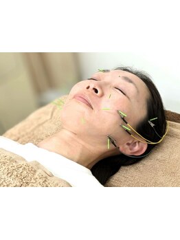 小顔になりたい