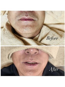 ティアレ 緑井店(Tiare)/