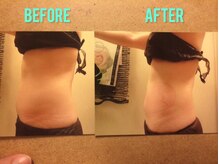 エムドゥービー(Mde`B)/本気のダイエット痩身コース