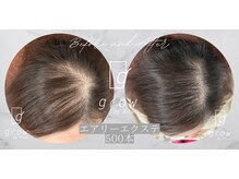 頭皮ケア専門サロン グロウ(grow by k-two)/地肌の気になるにさくっと！