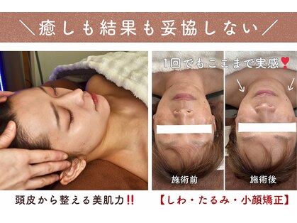 ウミン(UMIN)の写真