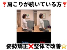 えびす整骨院 南浦和院/肩こりは姿勢矯正×全身整体♪