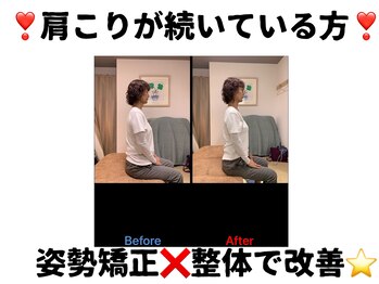 えびす整骨院 南浦和院/肩こりは姿勢矯正×全身整体♪