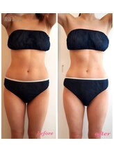 カウラ(Kaura)/中半身ビフォーアフター(肥後橋)