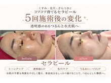 エアージーモ(Air Gmo)の雰囲気（肌質改善メニューセラピール・IPL光フェイシャル・小顔エステ）