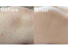 レアマカナ(LeaMakana)/ビフォーアフター