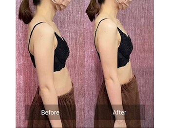 ハートランド(HEARTLAND)/プチ・クレオパトラ☆1回の施術