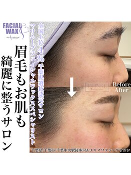 エリス(ELISSE)/フェイシャルワックスと眉毛
