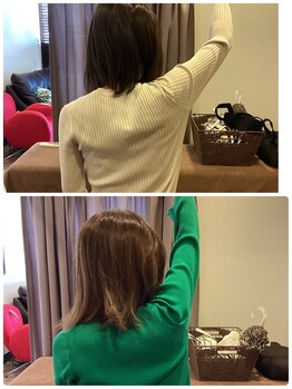 ヴィラ整骨院/五十肩の方にも◎