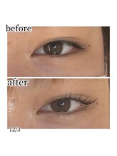 メルシートータルビューティー(MERCI)/