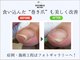 巻き爪補正店 鎌倉大船店の写真/巻き爪補正トップクラスの技で長年の爪の悩みを低負担で改善!【巻き爪補正1箇所+足の爪切りセット¥7,700】