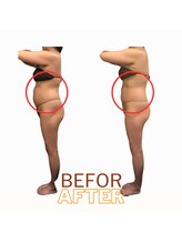 アールユー ギンザ(Ryou ginza)/しぶとい下腹撃退！