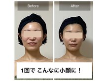 ビィミング(beaming)の雰囲気（身体から整えてキュッと引き締まった小顔に）