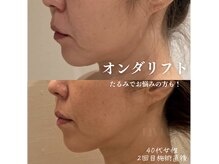 リビア(LIVIA)の雰囲気（痩せるのは当たり前！他サロンとの圧倒的な違いをご実感下さい♪）
