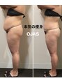 オージャス(OJAS) 痩身サロン OJAS